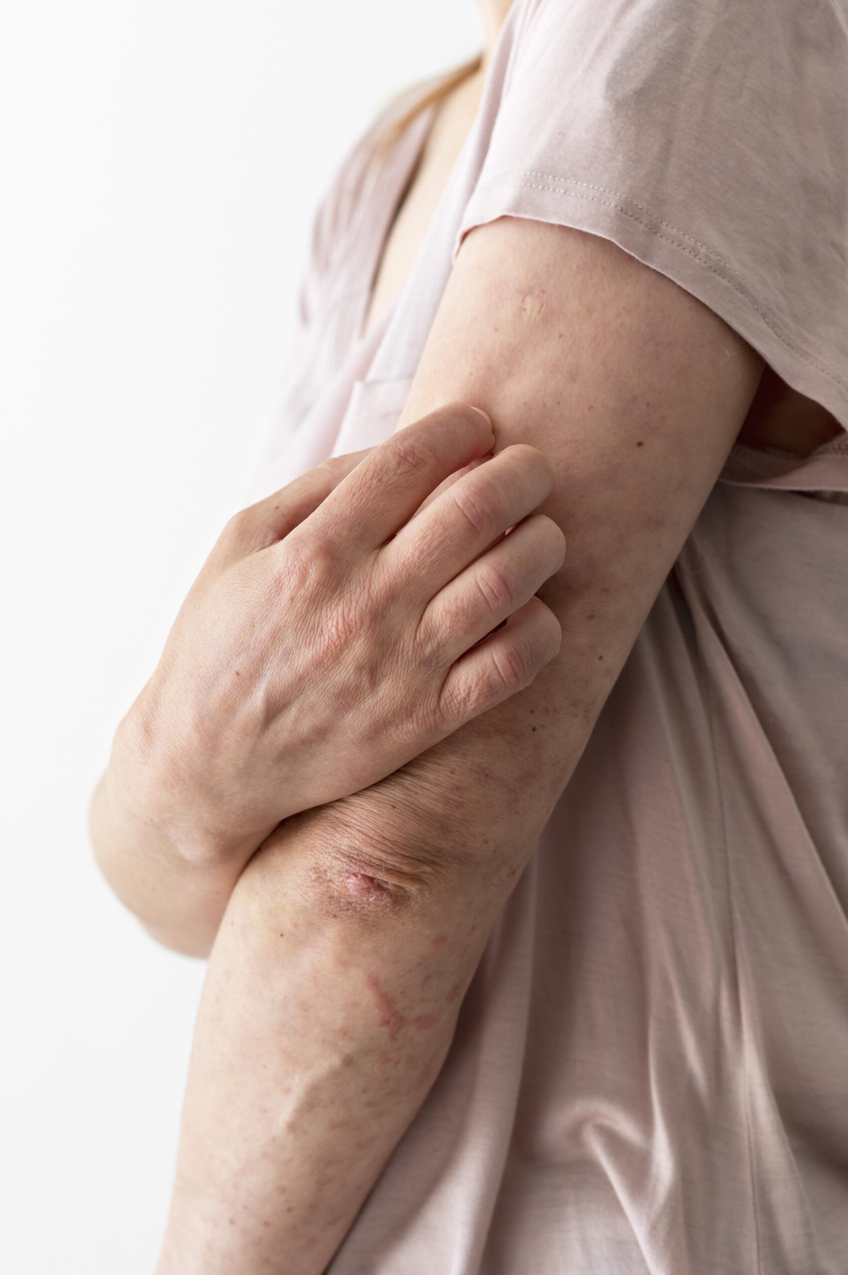 Ansiedad o problema neurológico? El hormigueo en manos, pies o cara explicado